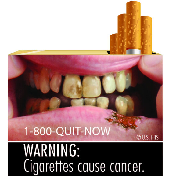 Fda Unveils Graphic Cigarette Labels Shots Health News Npr