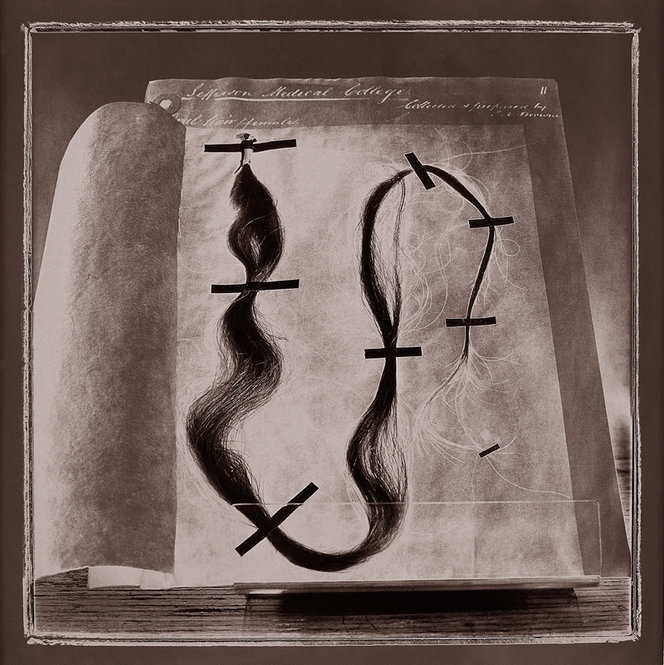 Quays Focus 'Weeping Glass' On The Mutter Museum NPR