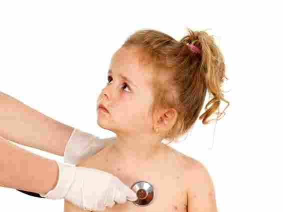 Chickenpox