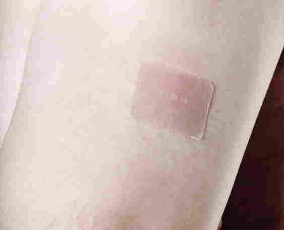 An older man wears a nicotine patch on his left arm.