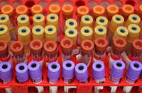 If there's a test for it, chances are a storefront lab is eager to help you have it done.
