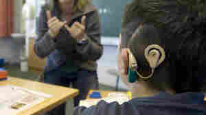 Cochlear Implants Redefine What It Means To Be Deaf