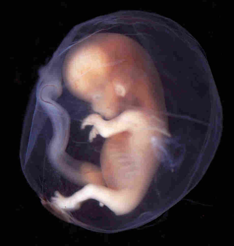 Human embryo