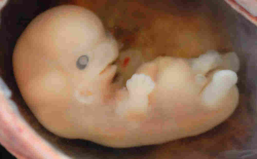 Human embryo