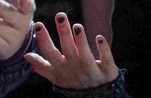 Nail close-up showing ragged manicure