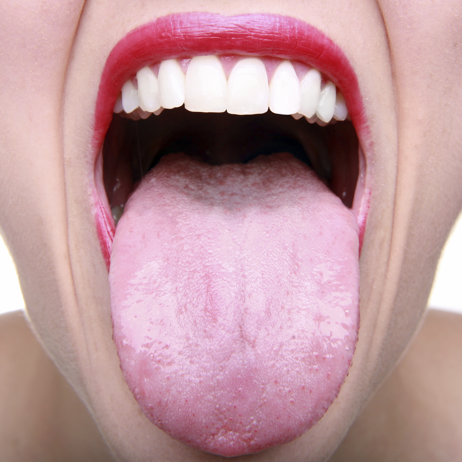 What Can Make Your Mouth And Tongue Sore