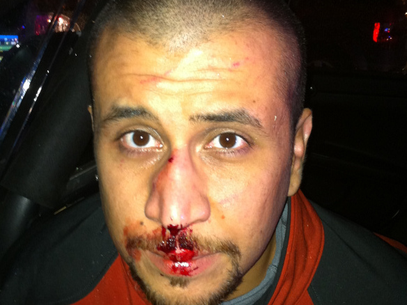 A photograph of George Zimmerman on the night he shot Trayvon Martin. Newly Released Color Photo Shows A Bloodied George Zimmerman
