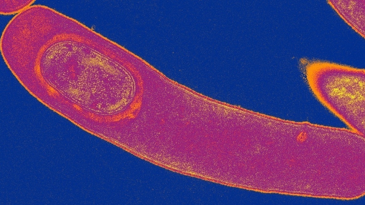 Токсины клостридиум диффициле. Клостридиум difficile. Clostridium difficile. Клостридиум difficile. Clostridium difficile.