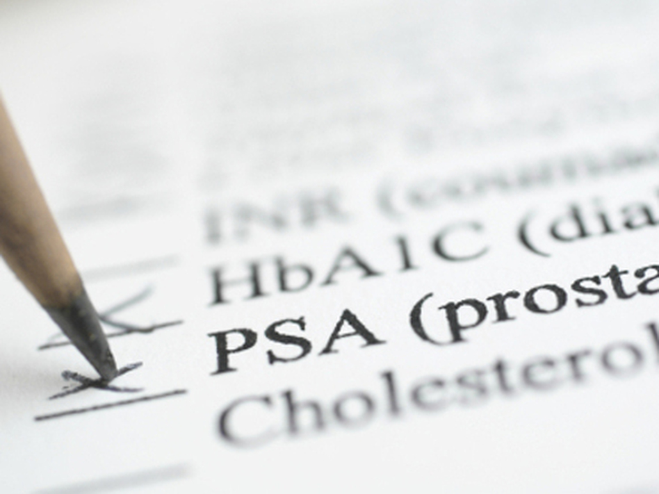 When is the right time to check the PSA box? (iStockphoto.com)