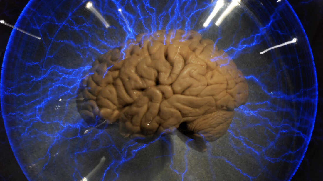 A human brain — part of a 2009 exhibition called "Brain: a world inside your head", in Sao Paulo, Brazil.