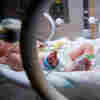 Feds Fault Preemie Researchers For Ethical Lapses