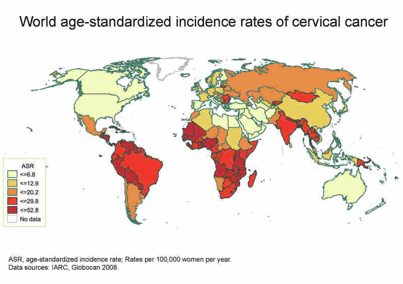 A map of cervical cancer rates around the world shows that they're highest in low-income countries.