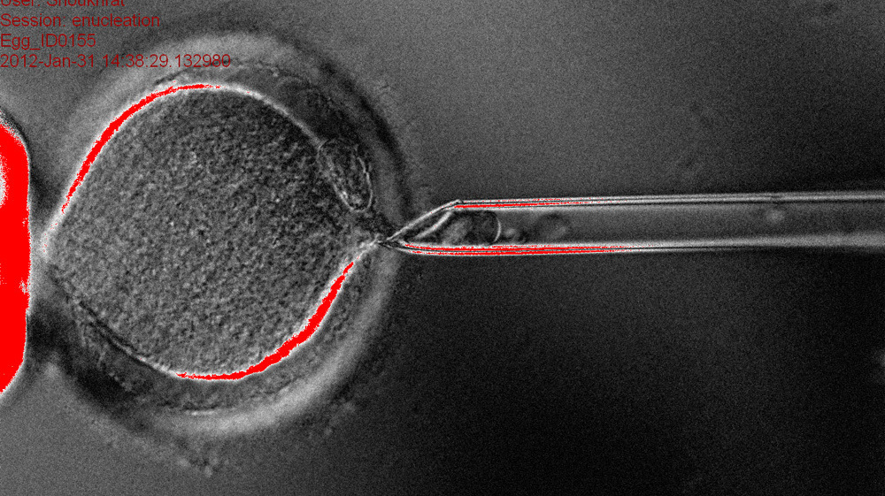 Scientists Clone Human Embryos To Make Stem Cells Shots Health News