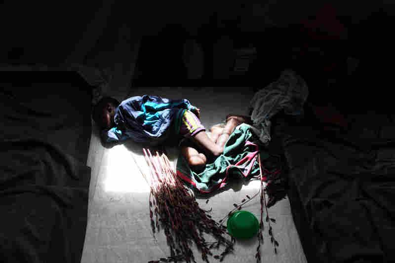 The staff has not yet diagnosed Gloria, 9, but believes she has what they refer to as nodding-plus — meaning she has symptoms of nodding syndrome, as well as more common epileptic seizures.