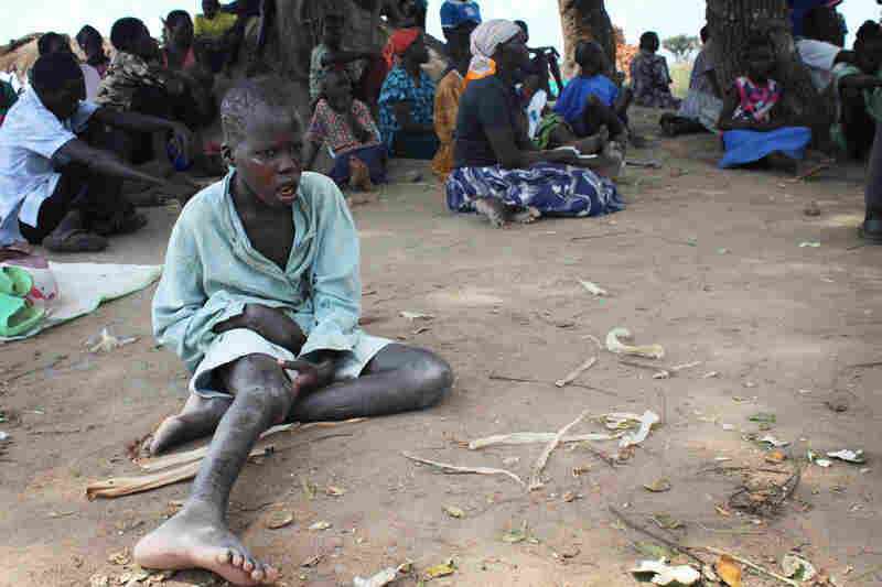 A child with nodding syndrome waits for treatment at an nodding syndrome outreach site in Pader district.