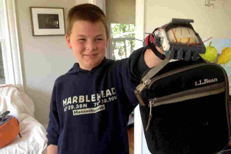 Leon McCarthy, 12, does not have fingers on his left hand. He used a Robohand at school for the first time last month.