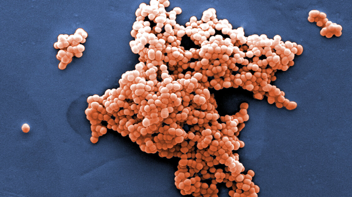 Streptococcus bacteria, like this strain, can be found in our guts. Streptococcus bacteria, like this strain, can be found in our guts.