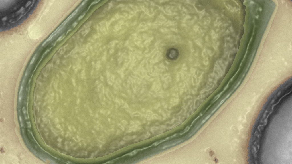 Самый большой вирус. Размеры вирусов. Древние гигантские вирусы. Мимивирус. Самый большой вирус.