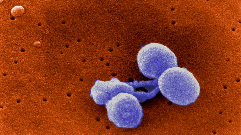<em>S.pneumoniae</em> bacteria may look harmless, but don't rile them. (CDC)