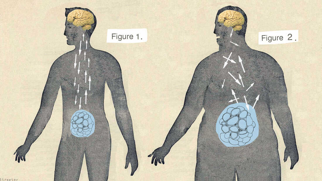 Calling Obesity A Disease May Make It Easier To Get Help Shots Health News Npr