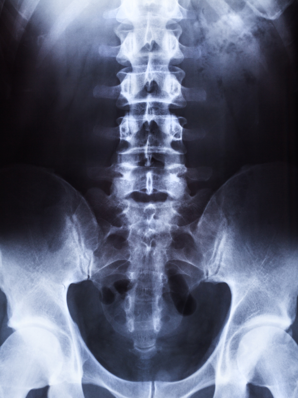 The price for an X-ray is murkier than the image. (iStockphoto.com)