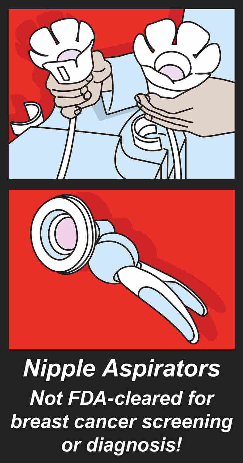 The FDA has not approved nipple aspiration for cancer tests.