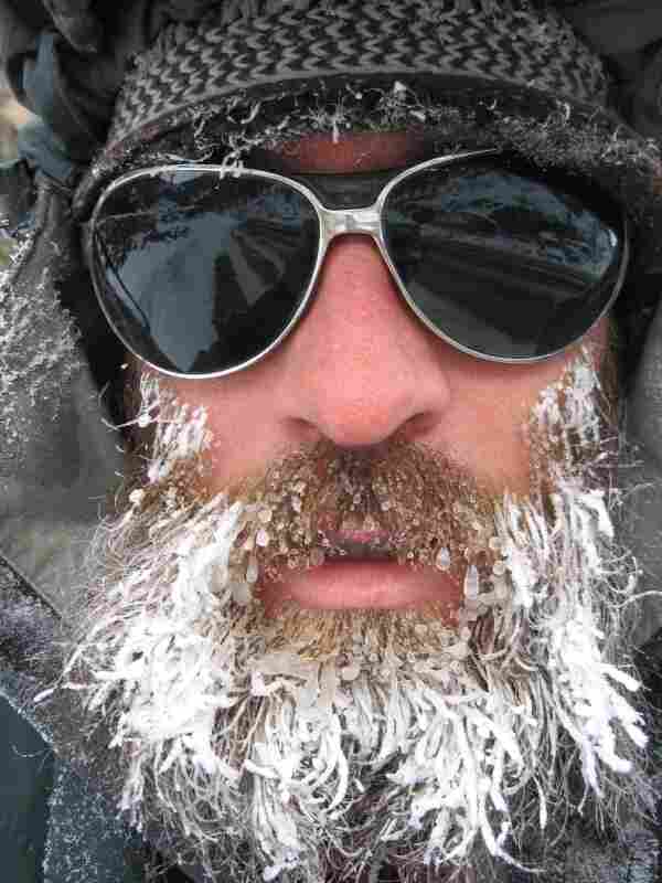 Man with icy beard.