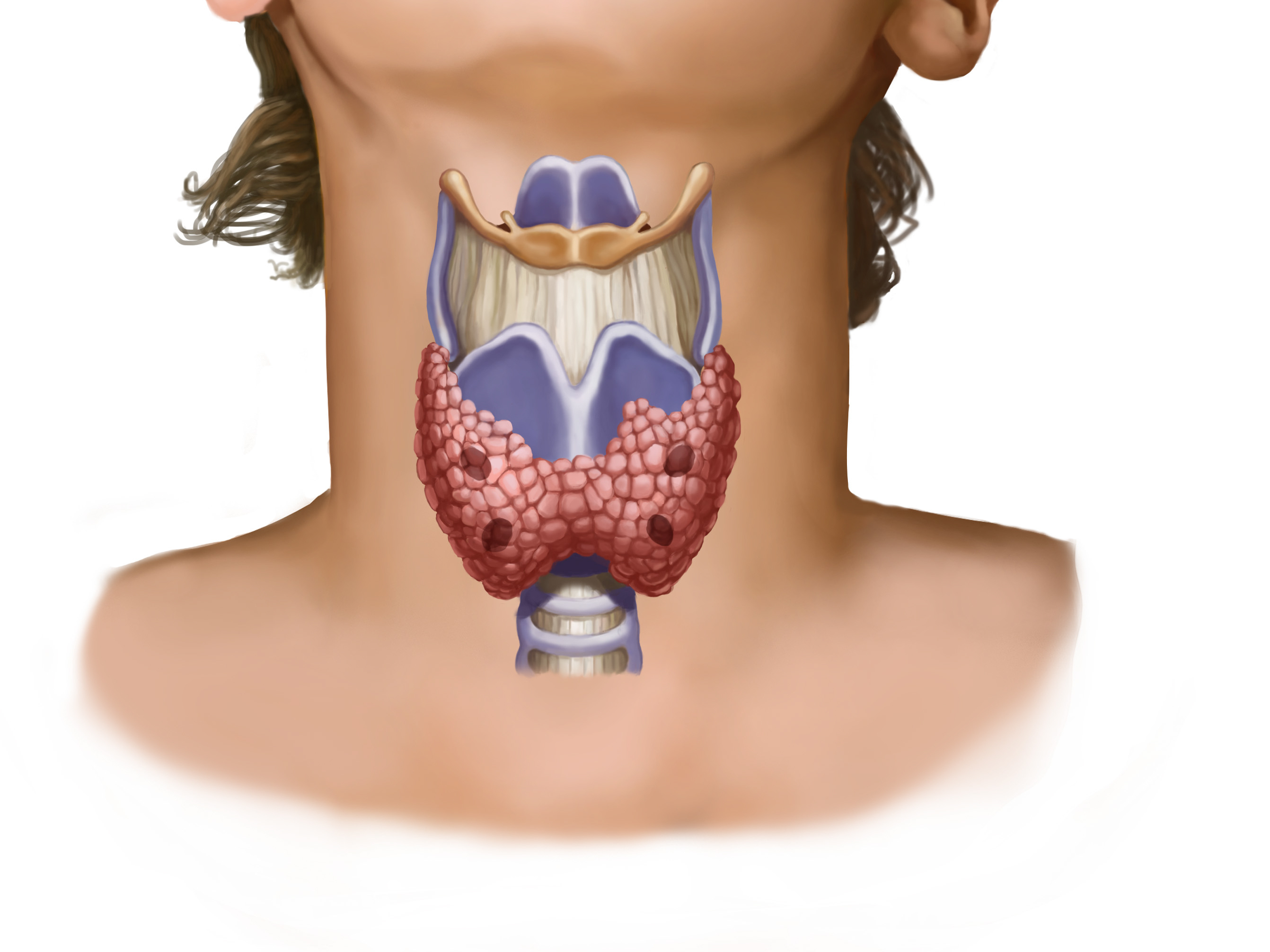 thyroid