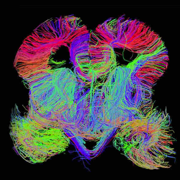 Map Of The Developing Human Brain Shows Where Problems Begin