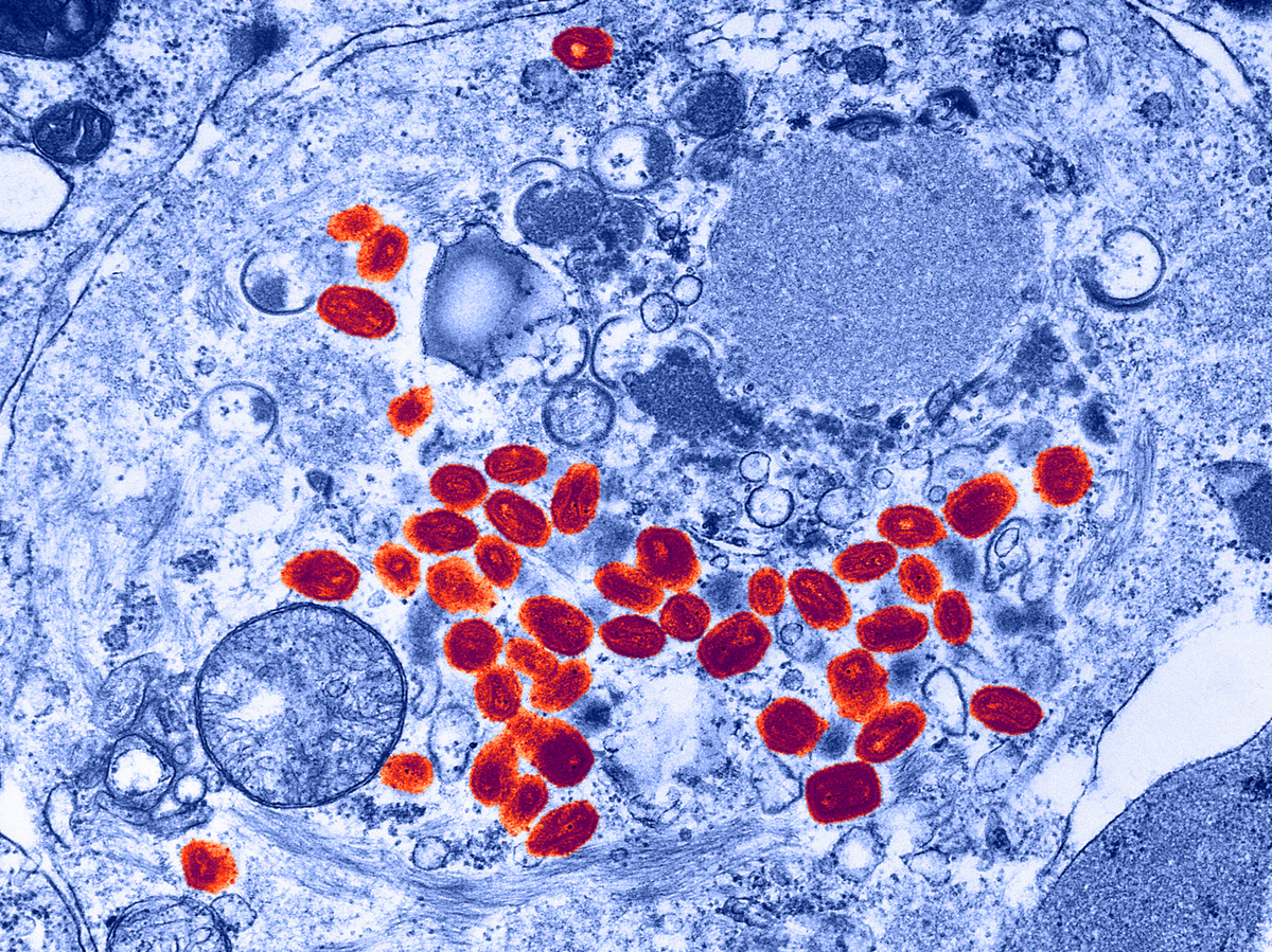 Smallpox Virus Found In Unsecured NIH Lab : Shots - Health News : NPR