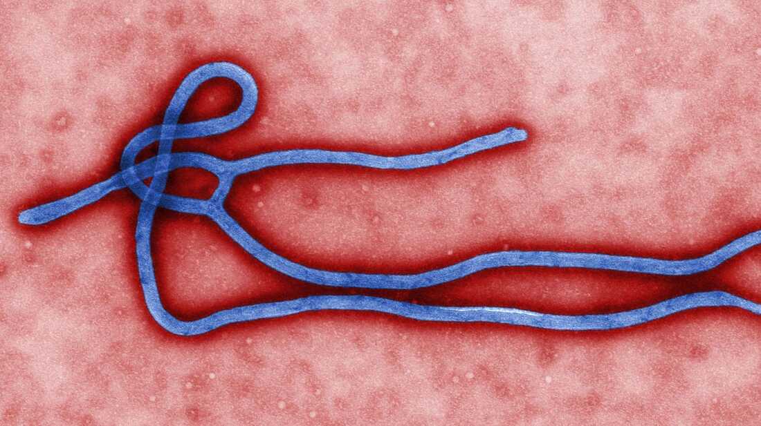 The fatality rate in an Ebola outbreak ranges from 25 percent to 90 percent.
