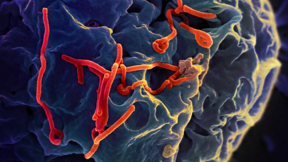 Scanning electron micrograph shows Ebola virus (red) on the surface of a kidney cell from an African green monkey. (NIAID)