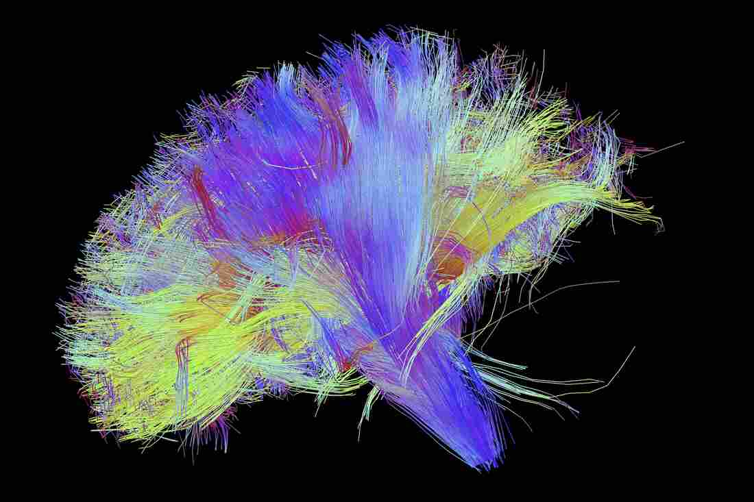 A diffusion spectral imaging (DSI) scan of the bundles of white matter nerve fibers in the brain. The fibers transmit nerve signals among brain regions and between the brain and the spinal cord.