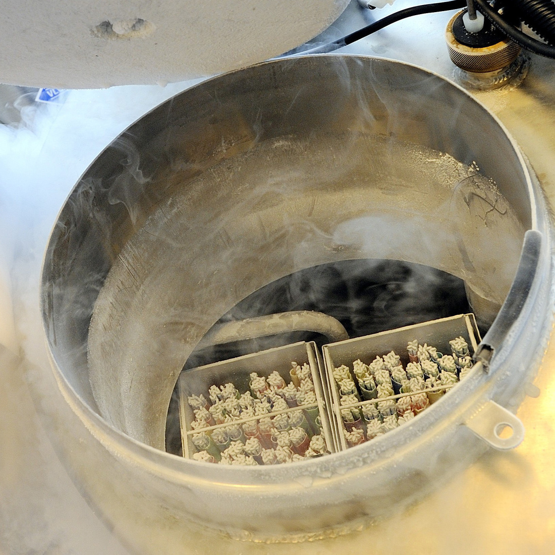 Women Can Freeze Their Eggs For The Future, But At A Cost Shots