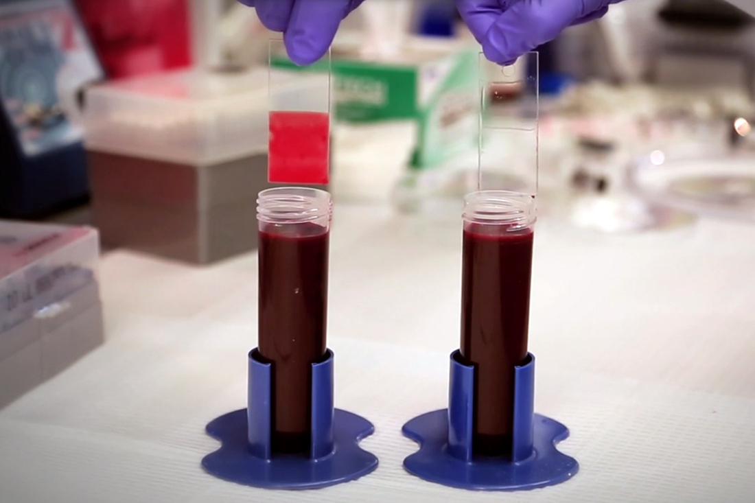 Slippery When Coated Helping Medical Devices Prevent Blood Clots