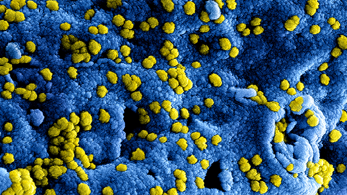 How A Tilt Toward Safety Stopped A Scientist's Virus Research : Shots -  Health News : NPR