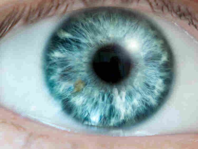 Environmental variations could affect heritability of biological traits, like nearsightedness.