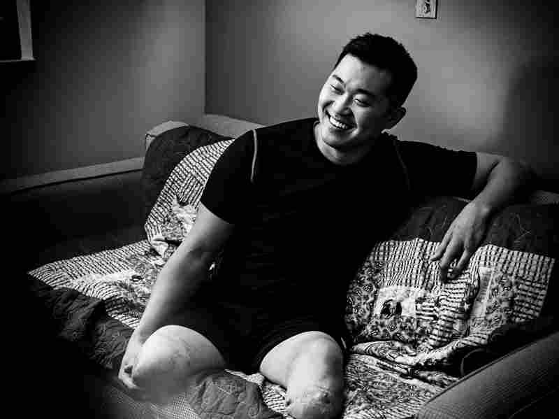 On Dec. 13, 2012, while on a foot patrol in Afghanistan, 1st Lt. Jason Pak was hit by a roadside bomb. The blast took his legs and part of his hand.