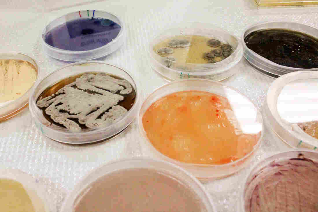 Petri dishes filled with colonies of microorganisms at Marrone Bio Innovations, in Davis, Calif.