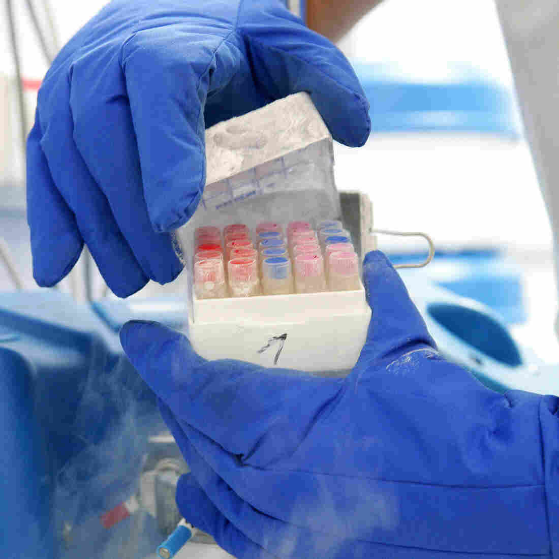 Eggs may be more vulnerable to freezing than embryos, but that's just one factor that affects the odds of having a baby with frozen eggs. Eggs may be more vulnerable to freezing than embryos, but that's just one factor that affects the odds of having a baby with frozen eggs.