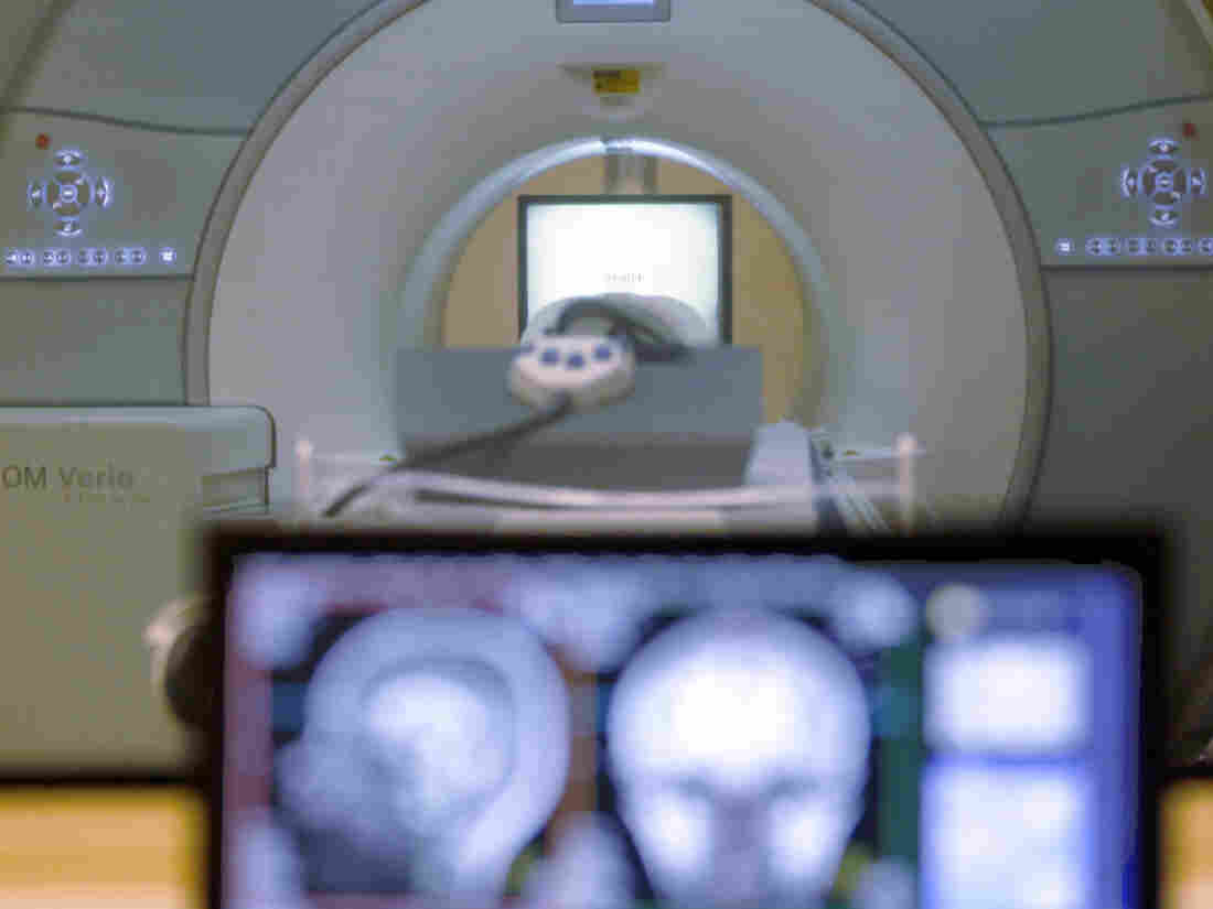 MRI