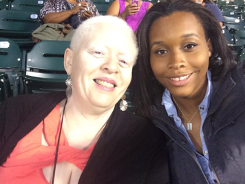 People Of Color With Albinism Ask Where Do I Belong Code Switch Npr