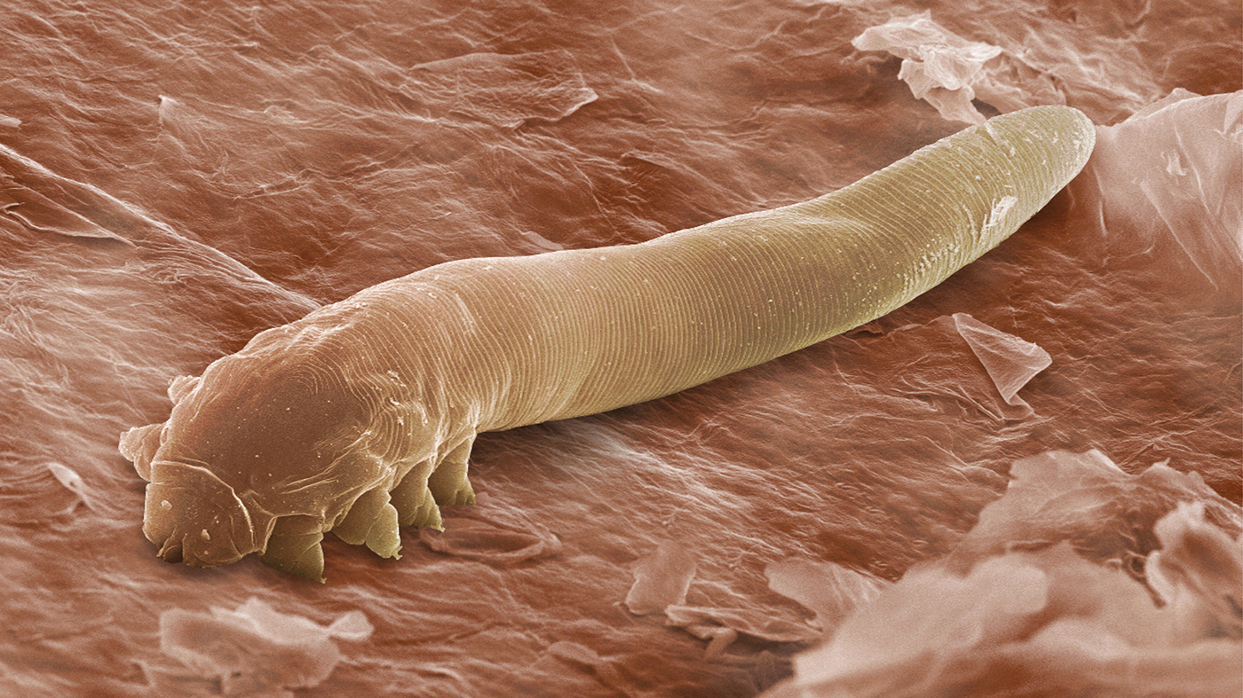 Eye mites: Millions of people have them and don't know it ...