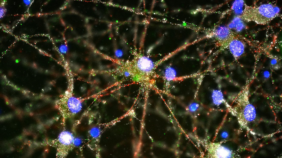 C4 proteins (green) are seen at the synapses in a culture of human neurons. (Heather de Rivera/McCarroll Lab/Harvard via AP)
