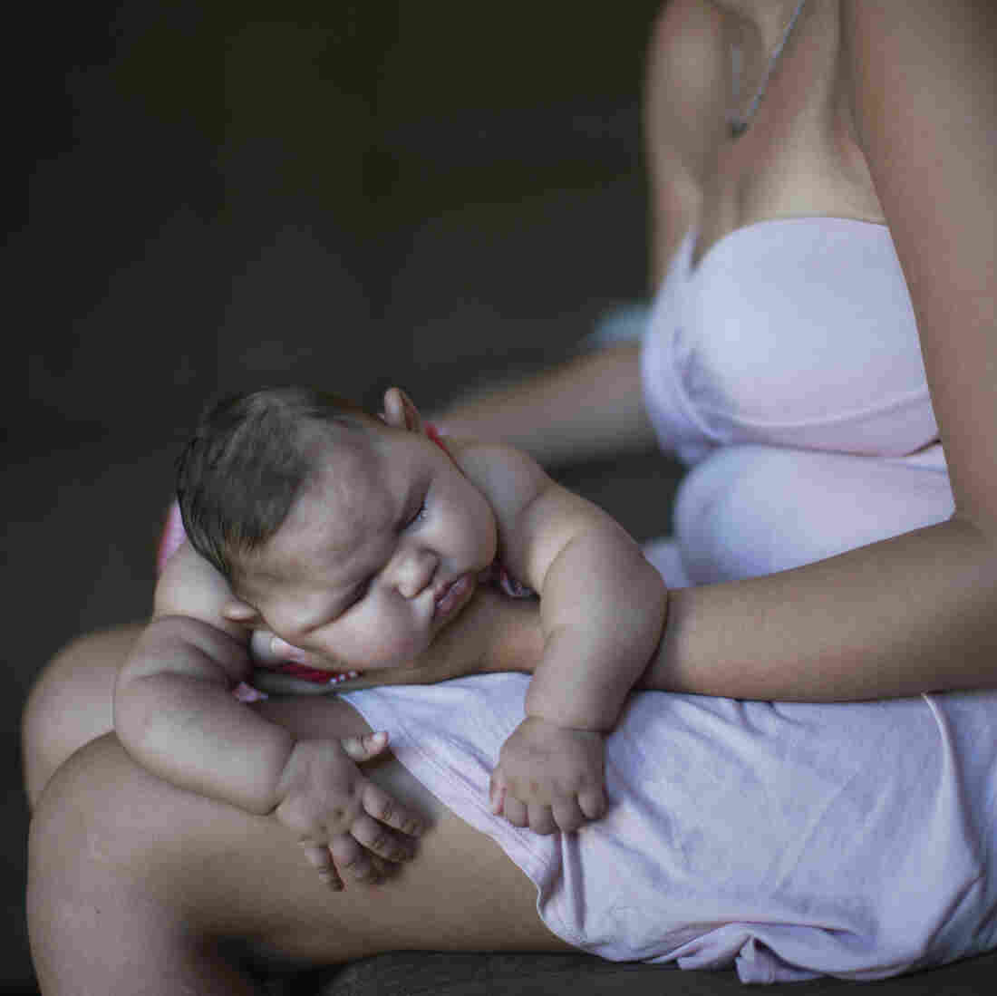 Gleyse Kelly da Silva holds her daughter, Maria Giovanna, who was born with microcephaly. Gleyse Kelly da Silva holds her daughter, Maria Giovanna, who was born with microcephaly.