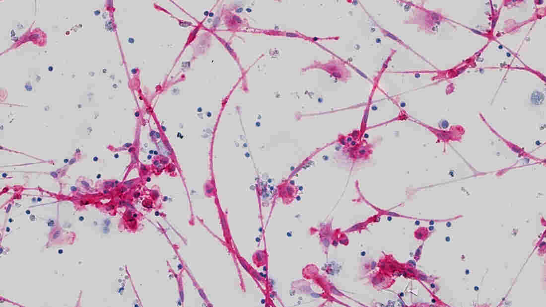 Fibrocytes