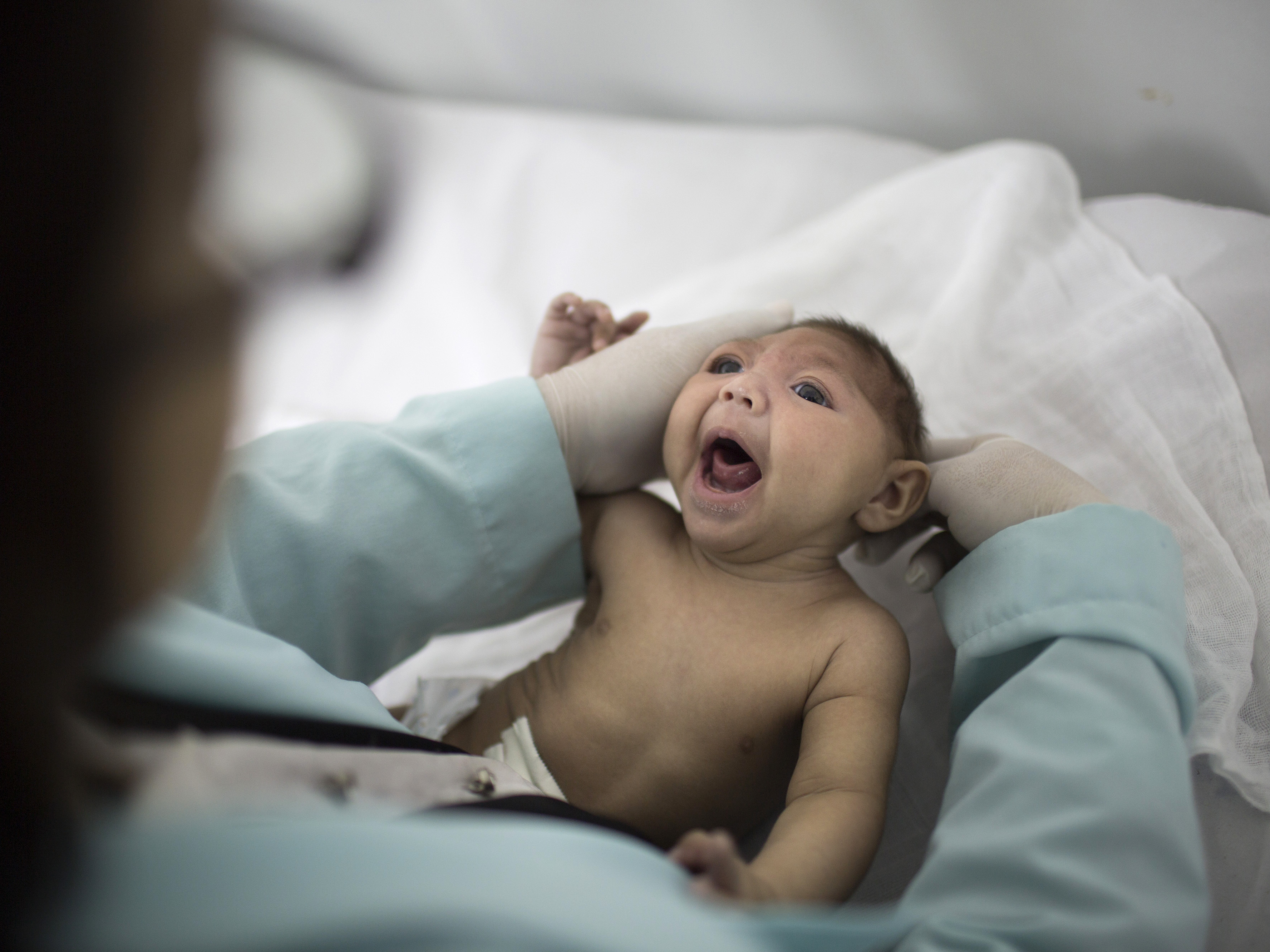 A baby born with microcephaly in Brazil is examined by a neurologist.