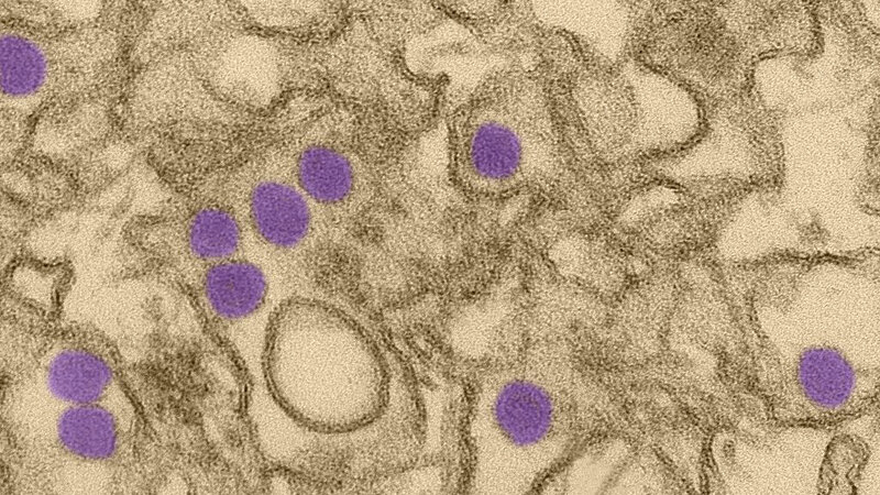 Sexually transmitted infections list cdc zika Sexually transmitted infections list cdc zika