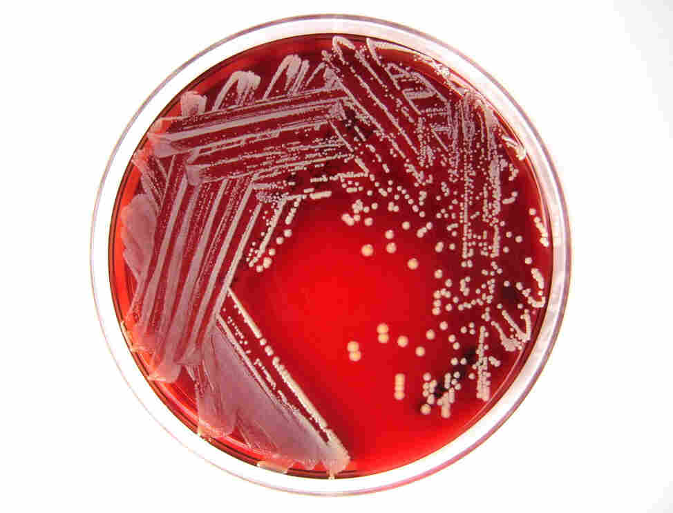 Once scientists grew these Staphylococcus lugdunensis bacteria in a lab dish, they were able to isolate a compound that's lethal to another strain commonly found in the nose that can make us sick  Staphylococcus aureus.