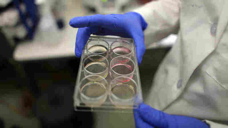 In this file photo, a professor holds a tray of stem cells at the University of Connecticut. The NIH plans to lift a moratorium on funding studies using human stem cells in animal embryos.